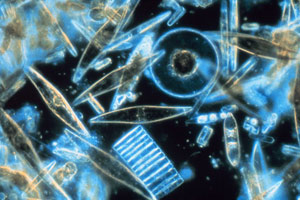 Phytoplankton under a microscope